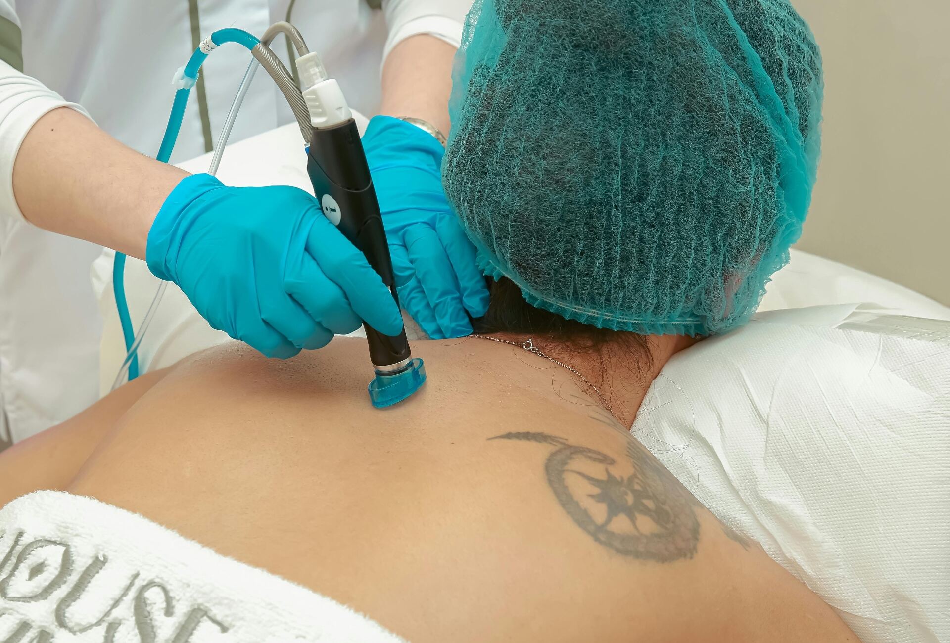 Détatouage