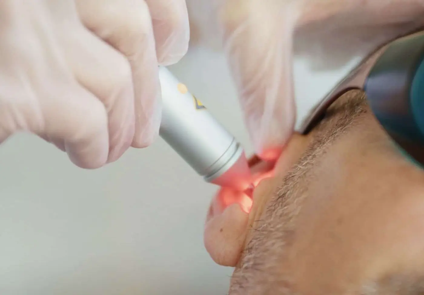 Laser contre les addictions